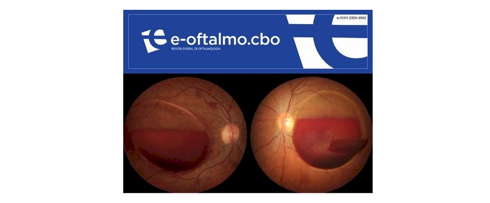 e-Oftalmo, a nova revista científica do CBO